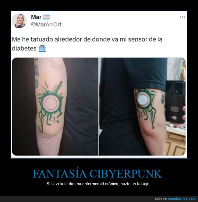 sensor,diabetes,tatuaje