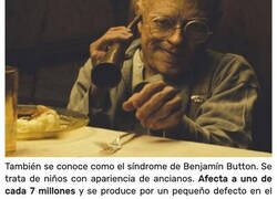 Enlace a Enfermedades que parecen sacas de películas