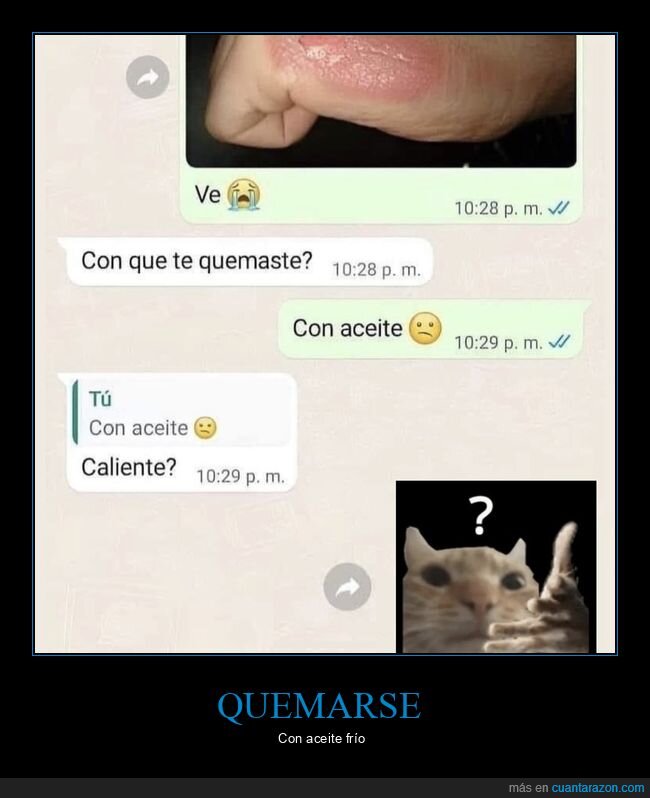 aceite,quemarse