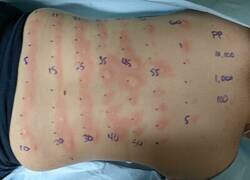 Enlace a Me está picando todo