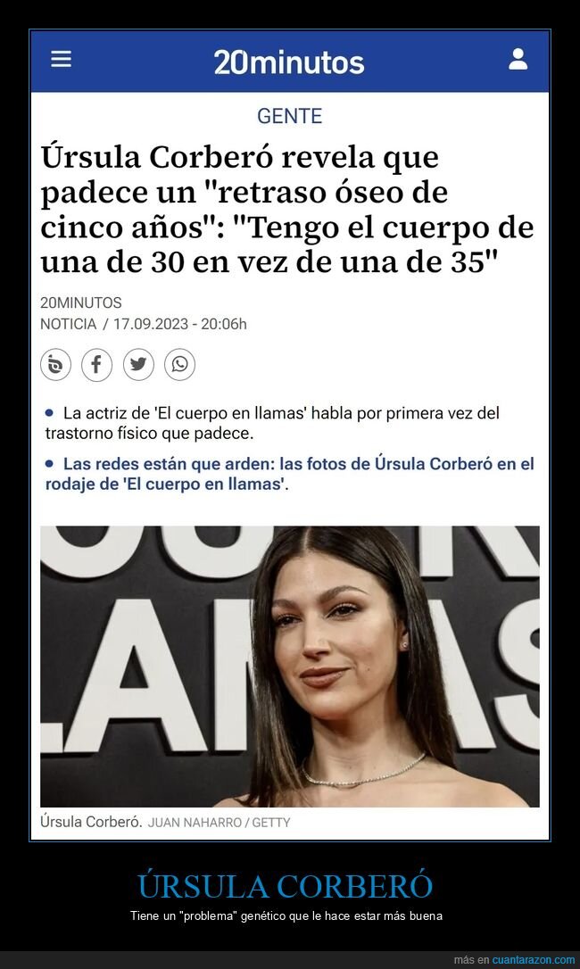 úrsula corberó,retraso óseo