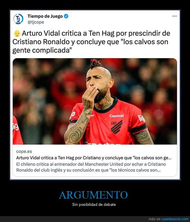 arturo vidal,calvos