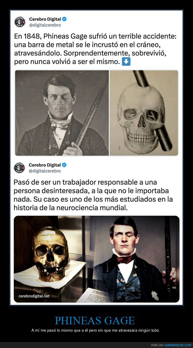 cráneo,curiosidades,phineas gage,tubo,wtf