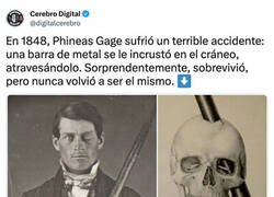 Enlace a El curioso caso de Phineas Gage
