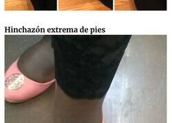 Enlace a Embarazadas cuyo día va peor que el tuyo