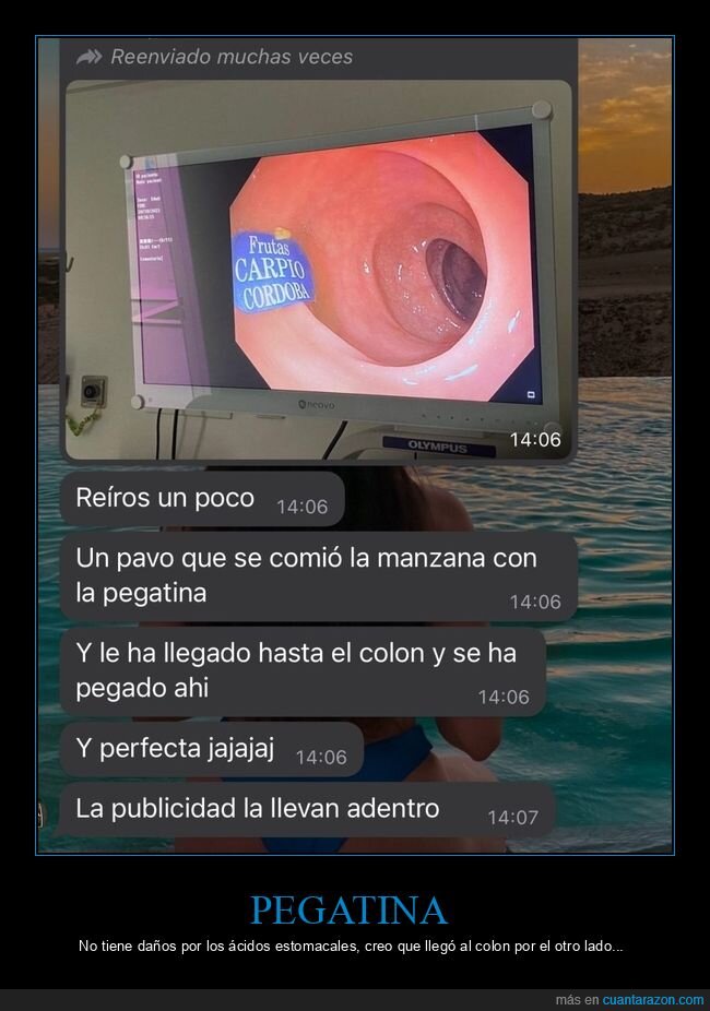 colonoscopia,manzana,pegatina,wtf