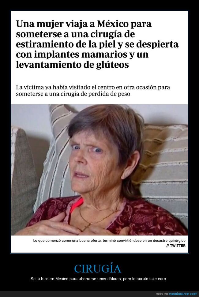 cirugía,fails,implantes,piel