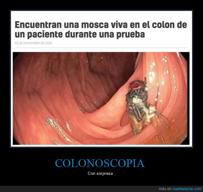 mosca,colonoscopia