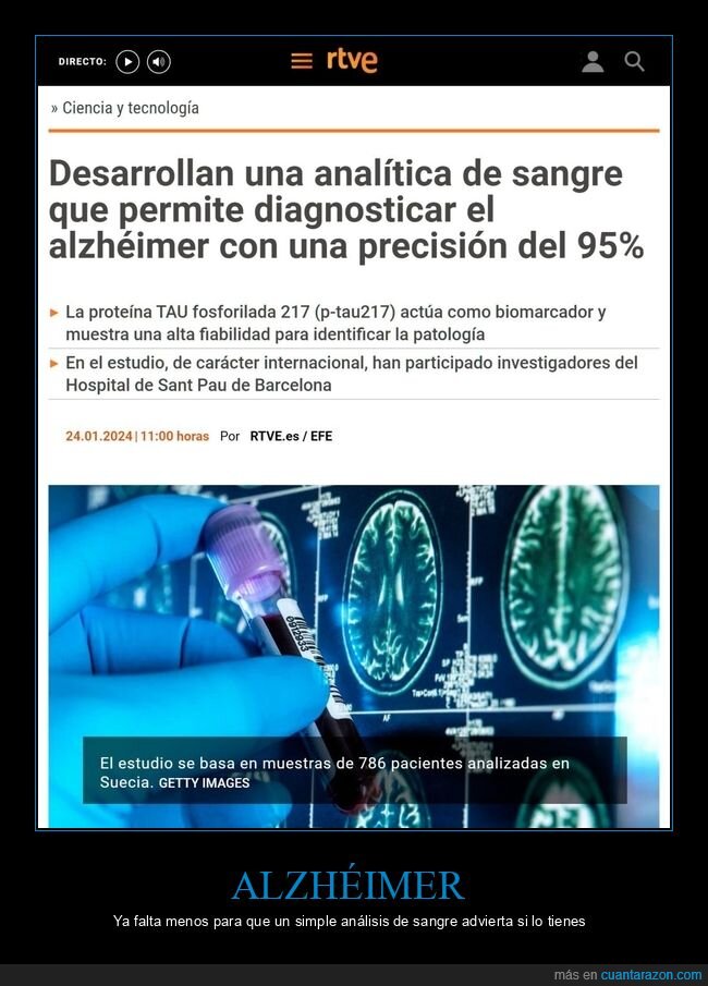 alzheimer,analítica