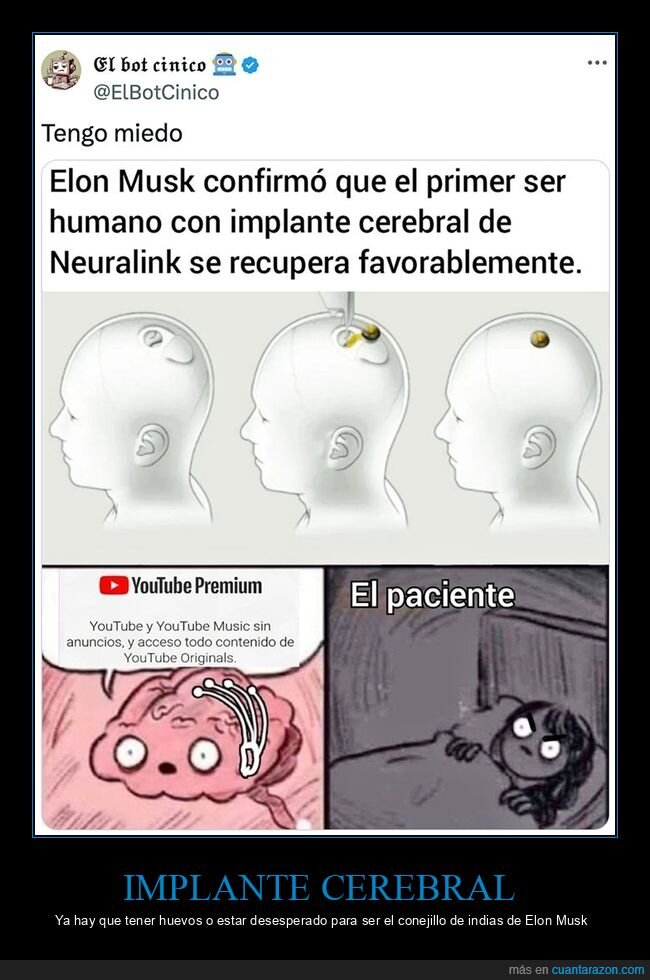 elon musk,humano,implante cerebral,neuralink
