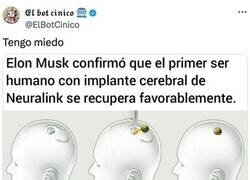 Enlace a Ya tenemos al primer humano con implante cerebral