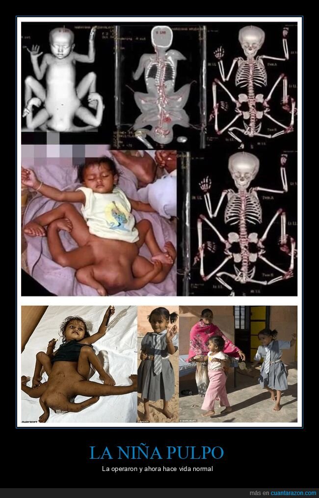 extremidades,niña,wtf