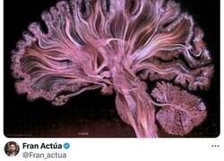 Enlace a Trucos psicológicos para activar tus sustancias químicas de la felicidad