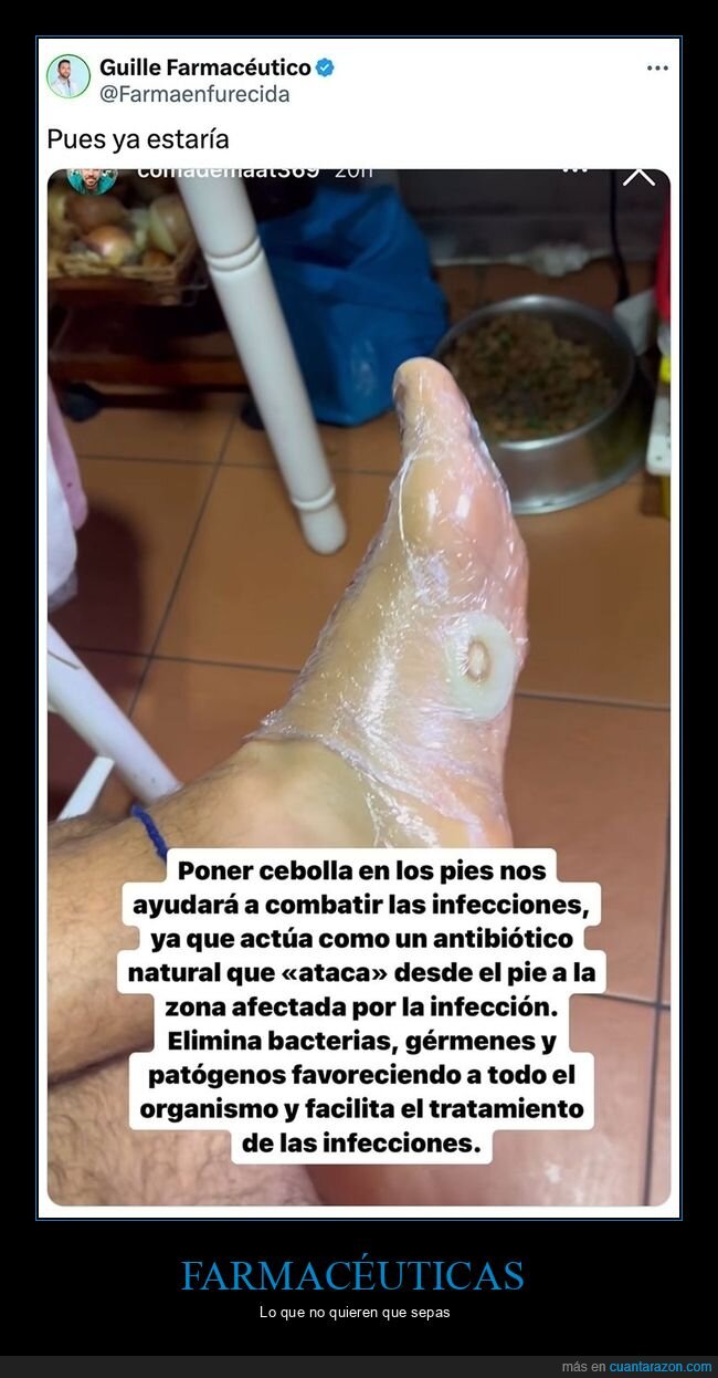 cebolla,infecciones,pies