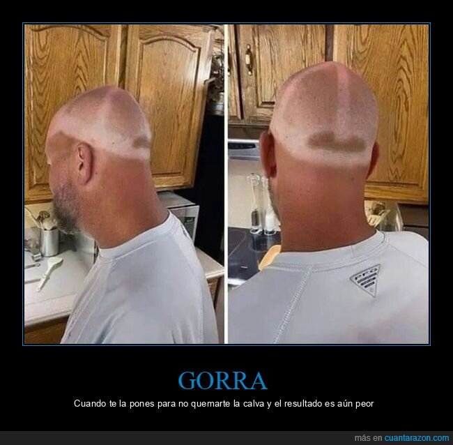 calvo,fails,gorra,marcas