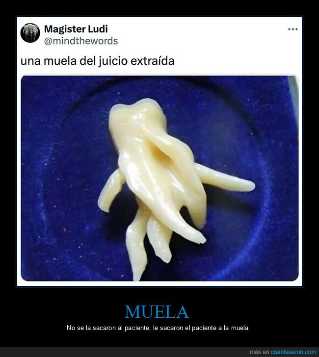 muela,muela del juicio,wtf