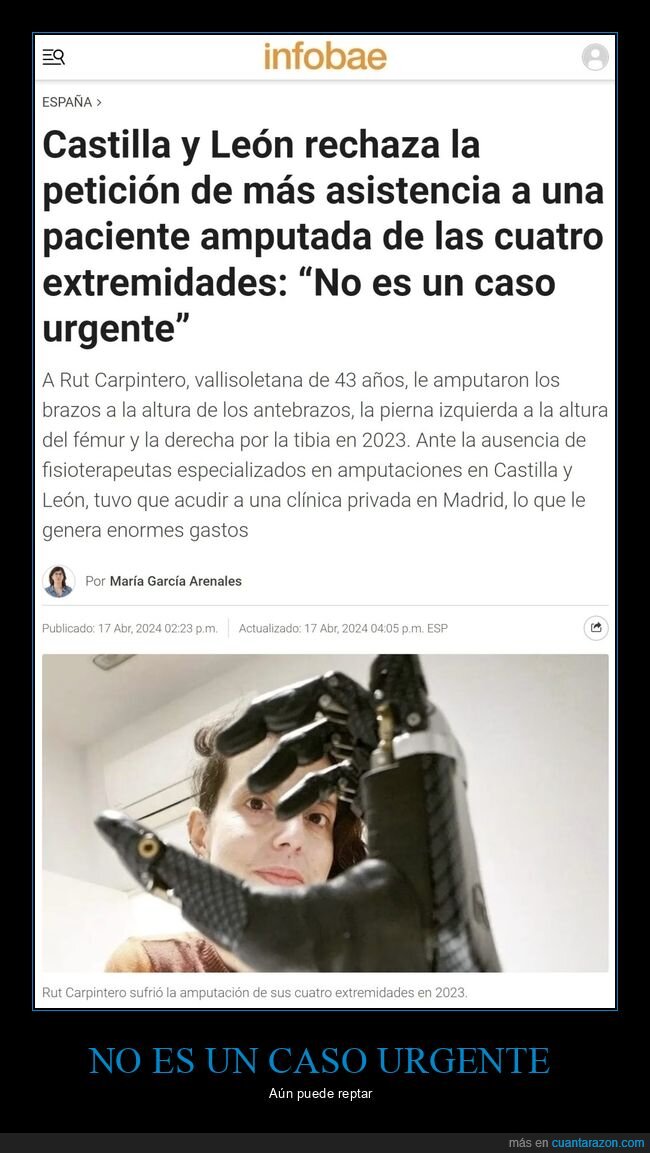 castilla y león,asistencia,paciente,amputada