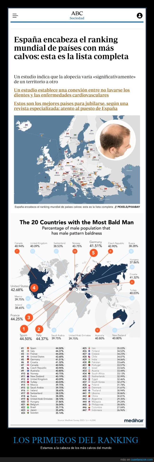 españa,calvos,ranking