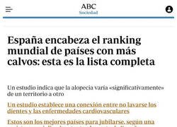 Enlace a Somos el país con más calvos