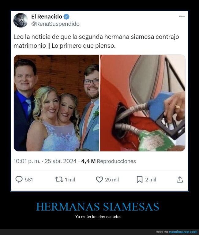 hermanas,siamesas,dos cabezas,boda