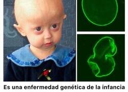 Enlace a Extrañas enfermedades que la ciencia no ha conseguido explicar