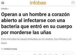 Enlace a Cuidado con morderse las uñas