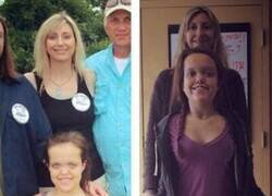 Enlace a ANTES Y DESPUÉS