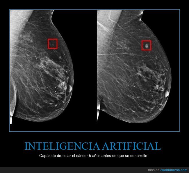 ia,cancer,mama,inteligencia artificial