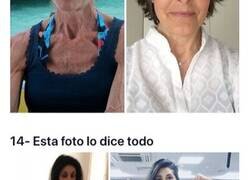 Enlace a Imágenes de la transformación de personas antes y después de superar la anorexia