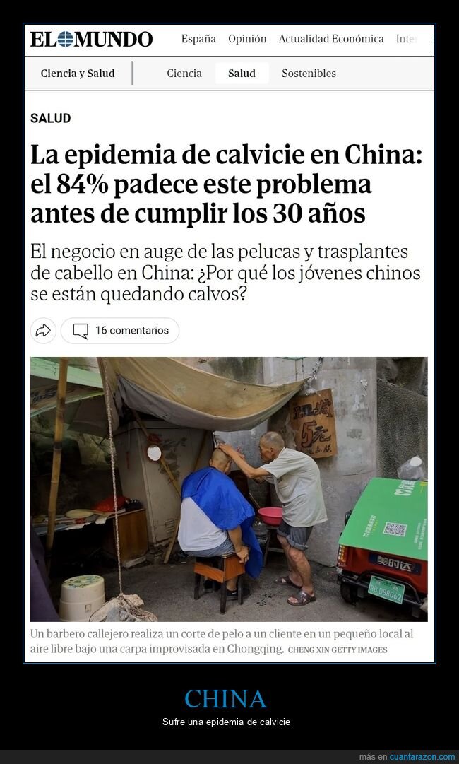 china,calvicie