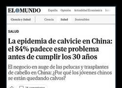 Enlace a Los chinos se están quedando calvos