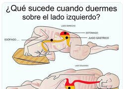 Enlace a ¿Es mejor dormir sobre el lado izquierdo o sobre el derecho?