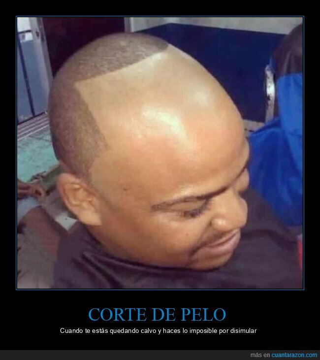 calvo,corte de pelo