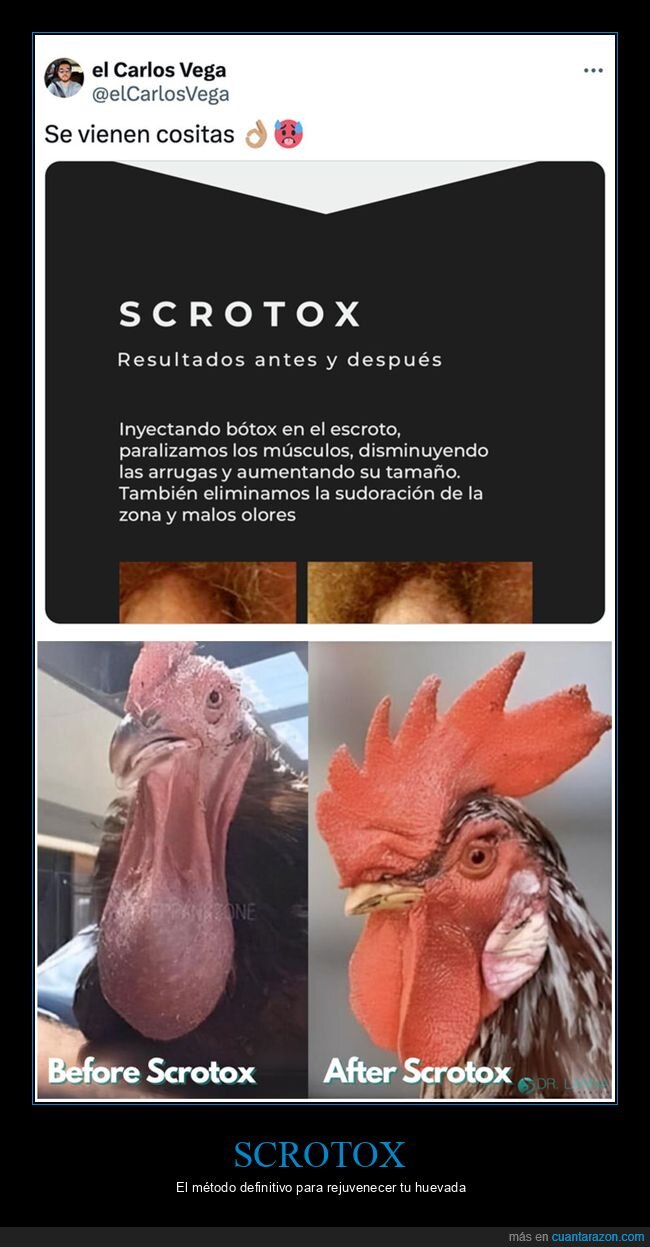 botox,scrotox