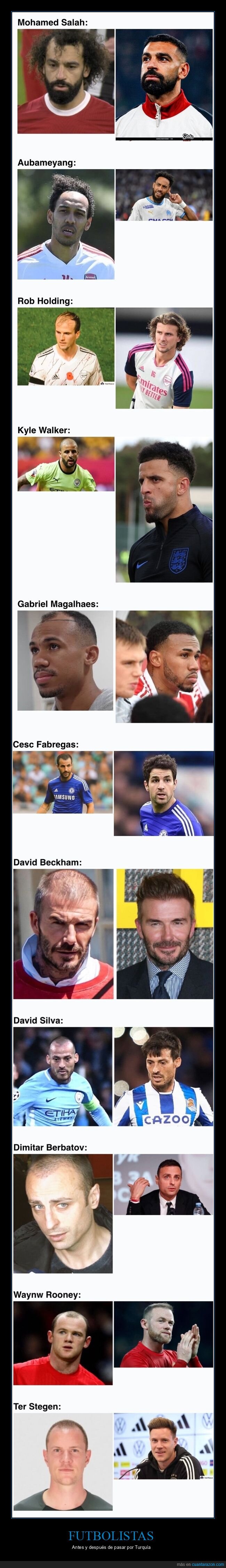 futbolistas,pelo,antes,después