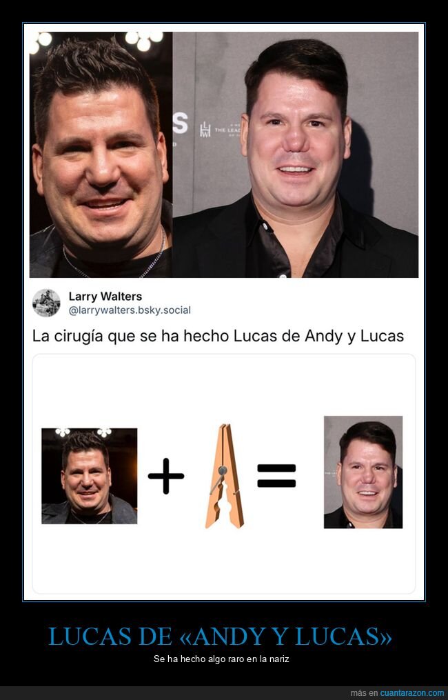 andy y lucas,nariz