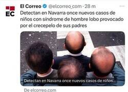 Enlace a Cuidado con los crecepelos...
