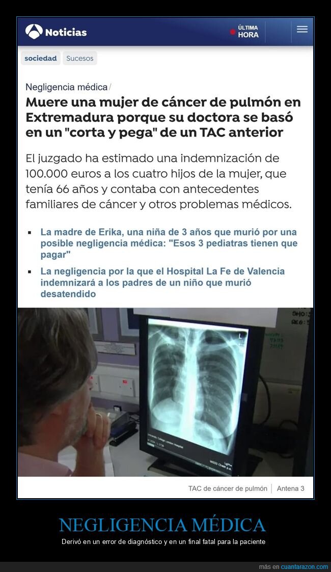 cáncer,muerte,tac,médico,negligencia