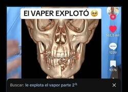 Enlace a Yo siempre he dicho que los vapers no eran de fiar