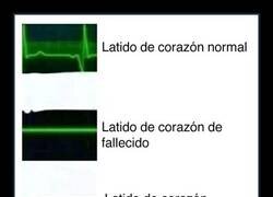 Enlace a Tengo cada día 4 infartos