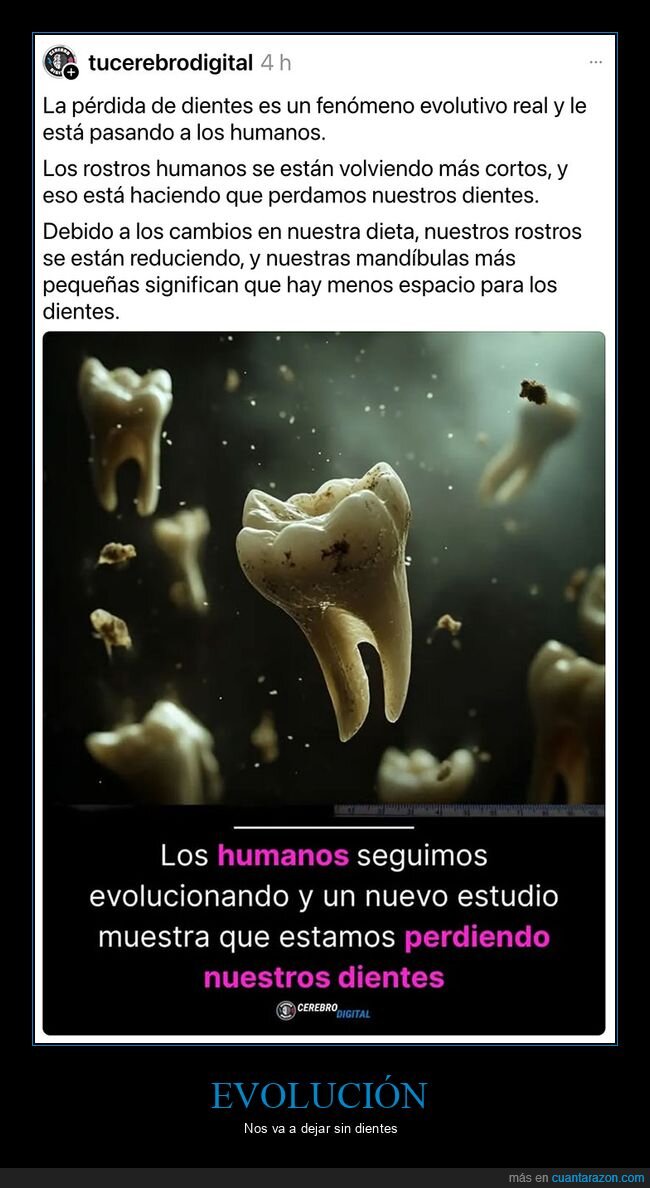 dientes,evolución