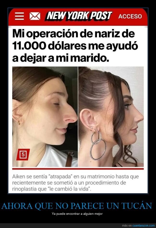 dejar,marido,nariz,operación