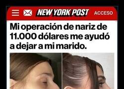 Enlace a Nariz nueva, vida nueva