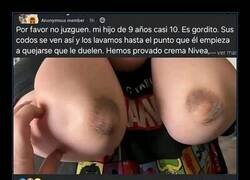 Enlace a Confusión lógica