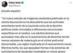 Enlace a Estudiando el cerebro de autoritaristas