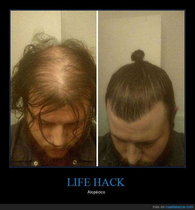 calvo,mono,pelo
