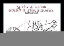 Enlace a El cerebro de cerca