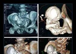 Enlace a Me parece de locos vivir 30 años con eso ahí enganchado