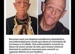 Enlace a Celebridades que aceptan sus peculiaridades únicas