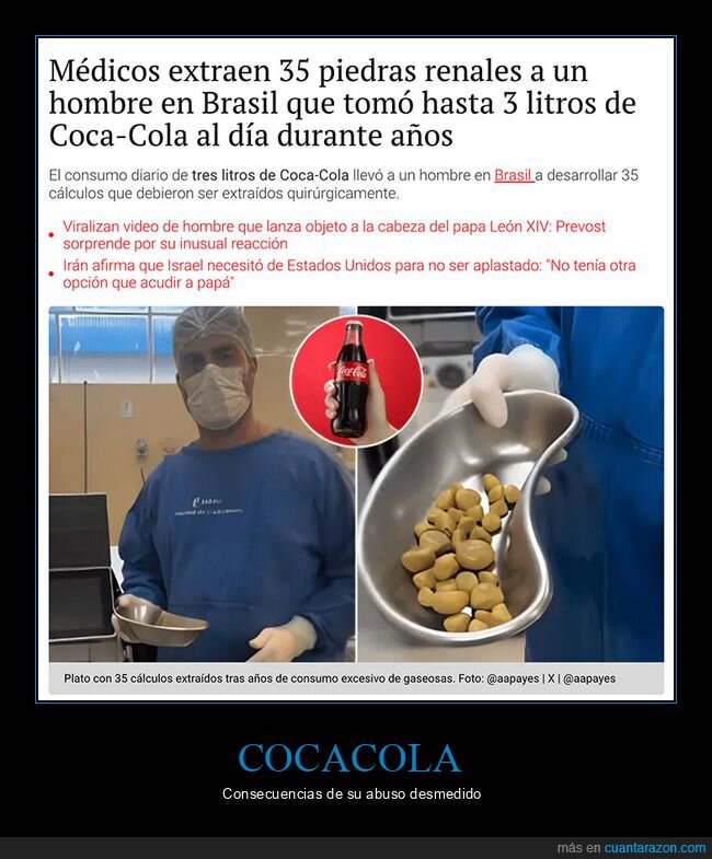 cálculos,cocacola,piedras,vejiga